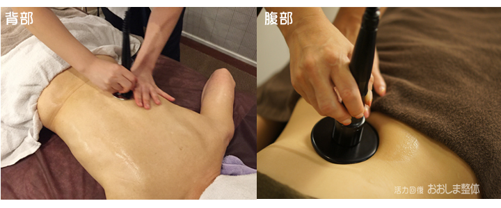 高周波治療器ラフォスによる整体｜女性整体師による東京 三軒茶屋 からだのことなら｜マッサージでは治らない身体の痛み、コリ、体調不良の悩みの改善に女性整体師によるポキポキしない痛くない本格整体