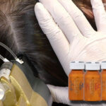 AC頭皮トリートメント｜薄毛・弱毛・抜け毛・白髪のお悩みに進化系ヘッドスパ AC頭皮トリートメント｜リアボーテAWP療法 ご予約・ご相談は安心の幹細胞美容専門『リアボーテ正規販売店 ビューティースキンラボ AnnaCarna〈からだのことなら〉』へ◆優秀賞受賞TOP15マスターサロン◆東京・外苑前駅すぐ◆完全予約制/個室完備/都度払い/勧誘なし◆クレアスキン・シェリースキン・グランスキン・リアムール・エキスパートローション・マックスボディ・美顔器