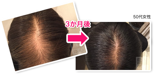 お試し幹細胞頭皮トリートメント｜【東京 港区 北青山】「からだのことなら」は、肌・髪・体・心の悩み改善に「丁寧に寄り添う」メディカル系ケア施術院です。薄毛・抜け毛・フケ・弱毛・頭皮のトラブル・白髪などでお悩みなら1度ご来院下さい。ACトリートメントとリアムール商品を使ったヘッドマッサージで頭皮ケアを行います。