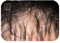 お試し幹細胞頭皮トリートメント｜【東京 世田谷区】「三軒茶屋 からだのことなら」は、肌・髪・体・心の悩み改善に「丁寧に寄り添う」メディカル系ケア施術院です。薄毛・抜け毛・フケ・弱毛・頭皮のトラブル・白髪などでお悩みなら1度ご来院下さい。ACトリートメントとリアムール商品を使ったヘッドマッサージで頭皮ケアを行います。