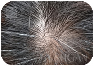お試し幹細胞頭皮トリートメント｜【東京 世田谷区】「三軒茶屋 からだのことなら」は、肌・髪・体・心の悩み改善に「丁寧に寄り添う」メディカル系ケア施術院です。薄毛・抜け毛・フケ・弱毛・頭皮のトラブル・白髪などでお悩みなら1度ご来院下さい。ACトリートメントとリアムール商品を使ったヘッドマッサージで頭皮ケアを行います。