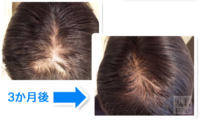 試し幹細胞頭皮トリートメント｜【東京 港区 北青山】「からだのことなら」は、肌・髪・体・心の悩み改善に「丁寧に寄り添う」メディカル系ケア施術院です。薄毛・抜け毛・フケ・弱毛・頭皮のトラブル・白髪などでお悩みなら1度ご来院下さい。ACトリートメントとリアムール商品を使ったヘッドマッサージで頭皮ケアを行います。