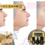 美容溶解トリートメント エクアエンマ ENMA |【高濃度ヒト幹細胞/iPSフェイシャル専門】iPS BioCellCare AnnaCarna 【リピ率9割超】≪肌質改善☆年齢肌☆小顔矯正 フェイシャルエステ/iPS×ヒト幹細胞≫◆芸能人ご用達の幹細胞コスメブランド「リアボーテ」専門店☆リアボーテクレアスキン化粧品・リアボーテグランスキン化粧品・リアボーテシェリースキン化粧品・エキスパートローション・アコライム・リアムール化粧品・エクラボーテ美顔器 正規取扱店｜口コミ・効果・使い方・ビフォーアフター・動画・写真・方法・通販・ネット販売・対象外商品★イネイト活性療法 整体院併設★東京都　港区 南青山 銀座線 外苑前駅 徒歩2分 個室完備