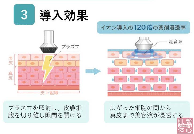 ３.導入効果　プラズマを照射し、皮膚細胞を切り離し隙間を開ける｜≪高濃度ヒト幹細胞培養液/iPSフェイシャル専門エステサロン≫ iPS BioCellCare AnnaCarna アンナカルナ【シミケア専科 プラズマ O:Celloオセロ 東京店 併設】肌質改善☆年齢肌☆小顔矯正☆シミ取り専門☆プラズマシミ取り放題◆プラズマシャワー・プラズマミスト・プラズマニードル◆芸能人ご用達コスメ「リアボーテ化粧品」正規販売店・クレアスキン・グランスキン・シェリースキン・エキスパートローション・リアムール・健美草◆購入方法・口コミ・効果・使い方・ビフォーアフター・動画・写真・通販・ネット販売対象外商品｜港区 南青山 銀座線 外苑前駅・青山一丁目駅◆個室完備・医療提携サロン・メディカルエステ