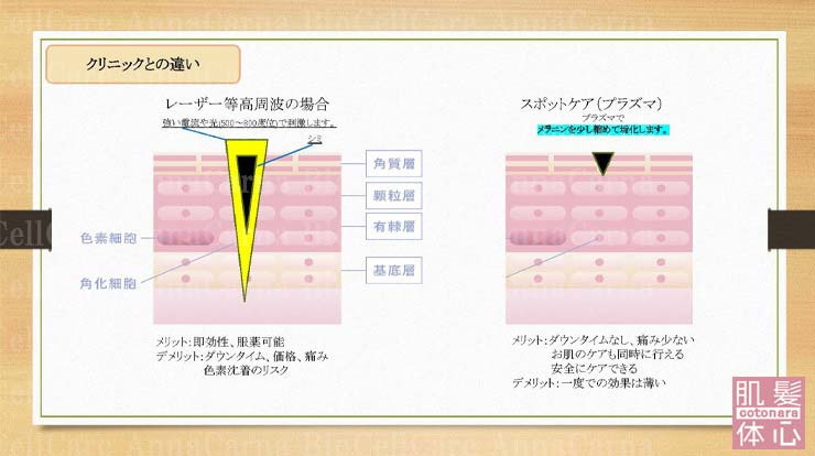 クリニックとの違い｜≪高濃度ヒト幹細胞培養液/iPSフェイシャル専門エステサロン≫ iPS BioCellCare AnnaCarna アンナカルナ【シミケア専科 プラズマ O:Celloオセロ 東京店 併設】肌質改善☆年齢肌☆小顔矯正☆シミ取り専門☆プラズマシミ取り放題◆プラズマシャワー・プラズマミスト・プラズマニードル◆芸能人ご用達コスメ「リアボーテ化粧品」正規販売店・クレアスキン・グランスキン・シェリースキン・エキスパートローション・リアムール・健美草◆購入方法・口コミ・効果・使い方・ビフォーアフター・動画・写真・通販・ネット販売対象外商品｜港区 南青山 銀座線 外苑前駅・青山一丁目駅◆個室完備・医療提携サロン・メディカルエステ