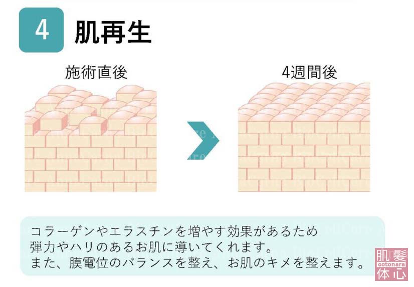 ４.肌再生　コラーゲンやエラスチンを増やす効果があるため弾力やハリのあるお肌に導いてくれます。膜電位のバランスを整え、お肌の決めを整えます｜≪高濃度ヒト幹細胞培養液/iPSフェイシャル専門エステサロン≫ iPS BioCellCare AnnaCarna アンナカルナ【シミケア専科 プラズマ O:Celloオセロ 東京店 併設】肌質改善☆年齢肌☆小顔矯正☆シミ取り専門☆プラズマシミ取り放題◆プラズマシャワー・プラズマミスト・プラズマニードル◆芸能人ご用達コスメ「リアボーテ化粧品」正規販売店・クレアスキン・グランスキン・シェリースキン・エキスパートローション・リアムール・健美草◆購入方法・口コミ・効果・使い方・ビフォーアフター・動画・写真・通販・ネット販売対象外商品｜港区 南青山 銀座線 外苑前駅・青山一丁目駅◆個室完備・医療提携サロン・メディカルエステ