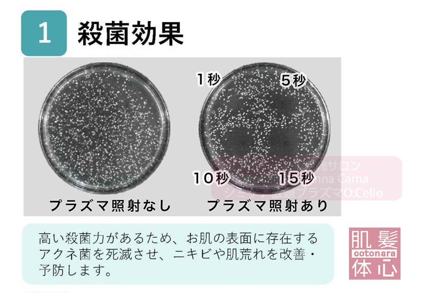 １．殺菌効果　高い殺菌力があるため、お肌の表面に存在するアクネ菌を死滅させ。ニキビや肌荒れを改善・予防します｜≪高濃度ヒト幹細胞培養液/iPSフェイシャル専門エステサロン≫ iPS BioCellCare AnnaCarna アンナカルナ【シミケア専科 プラズマ O:Celloオセロ 東京店 併設】肌質改善☆年齢肌☆小顔矯正☆シミ取り専門☆プラズマシミ取り放題◆プラズマシャワー・プラズマミスト・プラズマニードル◆芸能人ご用達コスメ「リアボーテ化粧品」正規販売店・クレアスキン・グランスキン・シェリースキン・エキスパートローション・リアムール・健美草◆購入方法・口コミ・効果・使い方・ビフォーアフター・動画・写真・通販・ネット販売対象外商品｜港区 南青山 銀座線 外苑前駅・青山一丁目駅◆個室完備・医療提携サロン・メディカルエステ