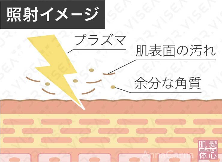 照射イメージ　プラズマ　肌表面の汚れ　余分な角質｜≪高濃度ヒト幹細胞培養液/iPSフェイシャル専門エステサロン≫ iPS BioCellCare AnnaCarna アンナカルナ【シミケア専科 プラズマ O:Celloオセロ 東京店 併設】肌質改善☆年齢肌☆小顔矯正☆シミ取り専門☆プラズマシミ取り放題◆プラズマシャワー・プラズマミスト・プラズマニードル◆芸能人ご用達コスメ「リアボーテ化粧品」正規販売店・クレアスキン・グランスキン・シェリースキン・エキスパートローション・リアムール・健美草◆購入方法・口コミ・効果・使い方・ビフォーアフター・動画・写真・通販・ネット販売対象外商品｜港区 南青山 銀座線 外苑前駅・青山一丁目駅◆個室完備・医療提携サロン・メディカルエステ