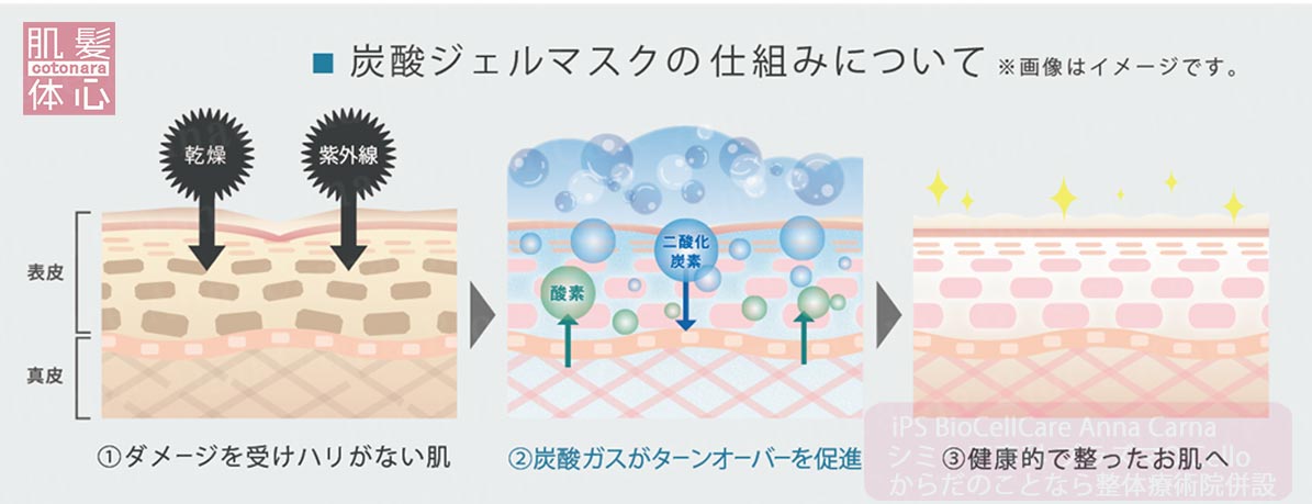 プラズマ炭酸ジェルマスク｜≪高濃度ヒト幹細胞培養液/iPSフェイシャル専門エステサロン≫ iPS BioCellCare AnnaCarna アンナカルナ【シミケア専科 プラズマ O:Celloオセロ 東京店 併設】肌質改善☆年齢肌☆小顔矯正☆シミ取り専門☆プラズマシミ取り放題◆プラズマシャワー・プラズマミスト・プラズマニードル◆芸能人ご用達コスメ「リアボーテ化粧品」正規販売店・クレアスキン・グランスキン・シェリースキン・エキスパートローション・リアムール・健美草◆購入方法・口コミ・効果・使い方・ビフォーアフター・動画・写真・通販・ネット販売対象外商品｜港区 南青山 銀座線 外苑前駅・青山一丁目駅◆個室完備・医療提携サロン・メディカルエステ