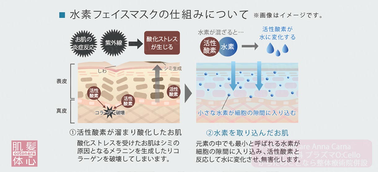 プラズマ水素マスク｜≪高濃度ヒト幹細胞培養液/iPSフェイシャル専門エステサロン≫ iPS BioCellCare AnnaCarna アンナカルナ【シミケア専科 プラズマ O:Celloオセロ 東京店 併設】肌質改善☆年齢肌☆小顔矯正☆シミ取り専門☆プラズマシミ取り放題◆プラズマシャワー・プラズマミスト・プラズマニードル◆芸能人ご用達コスメ「リアボーテ化粧品」正規販売店・クレアスキン・グランスキン・シェリースキン・エキスパートローション・リアムール・健美草◆購入方法・口コミ・効果・使い方・ビフォーアフター・動画・写真・通販・ネット販売対象外商品｜港区 南青山 銀座線 外苑前駅・青山一丁目駅◆個室完備・医療提携サロン・メディカルエステ