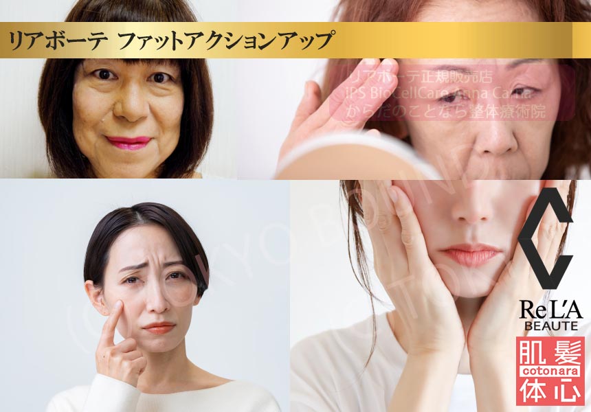 クレアスキン ファットアクションアップのご購入方法｜≪高濃度ヒト幹細胞培養液/iPSフェイシャル専門エステサロン≫ iPS BioCellCare AnnaCarna アンナカルナ【シミケア専科 プラズマ O:Celloオセロ 東京店 併設】肌質改善☆年齢肌☆小顔矯正☆シミ取り専門◆プラズマシャワー・プラズマミスト・プラズマニードル◆芸能人ご用達コスメ「リアボーテ化粧品」正規販売店・クレアスキン・グランスキン・シェリースキン・エキスパートローション・リアムール・健美草◆購入方法・口コミ・効果・使い方・ビフォーアフター・動画・写真・通販・ネット販売対象外商品｜港区 南青山 銀座線 外苑前駅・青山一丁目駅◆個室完備・医療提携サロン・メディカルエステ