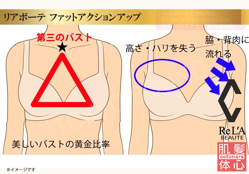 クレアスキン ファットアクションアップのご購入方法｜≪高濃度ヒト幹細胞培養液/iPSフェイシャル専門エステサロン≫ iPS BioCellCare AnnaCarna アンナカルナ【シミケア専科 プラズマ O:Celloオセロ 東京店 併設】肌質改善☆年齢肌☆小顔矯正☆シミ取り専門◆プラズマシャワー・プラズマミスト・プラズマニードル◆芸能人ご用達コスメ「リアボーテ化粧品」正規販売店・クレアスキン・グランスキン・シェリースキン・エキスパートローション・リアムール・健美草◆購入方法・口コミ・効果・使い方・ビフォーアフター・動画・写真・通販・ネット販売対象外商品｜港区 南青山 銀座線 外苑前駅・青山一丁目駅◆個室完備・医療提携サロン・メディカルエステ