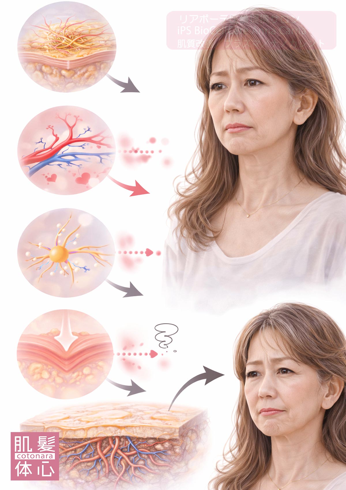 リアボーテ医療提携サロン AnnaCarna（アンナカルナ）のナノカレントで自然に整う横顔リフト印象比較