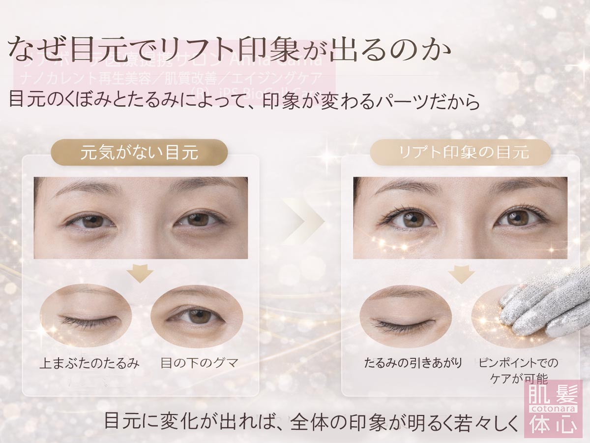 目元のたるみ・クマ印象を整えるナノカレント目元リフト|切らない・注射しない EYE RE:DESIGN 南青山 AnnaCarna