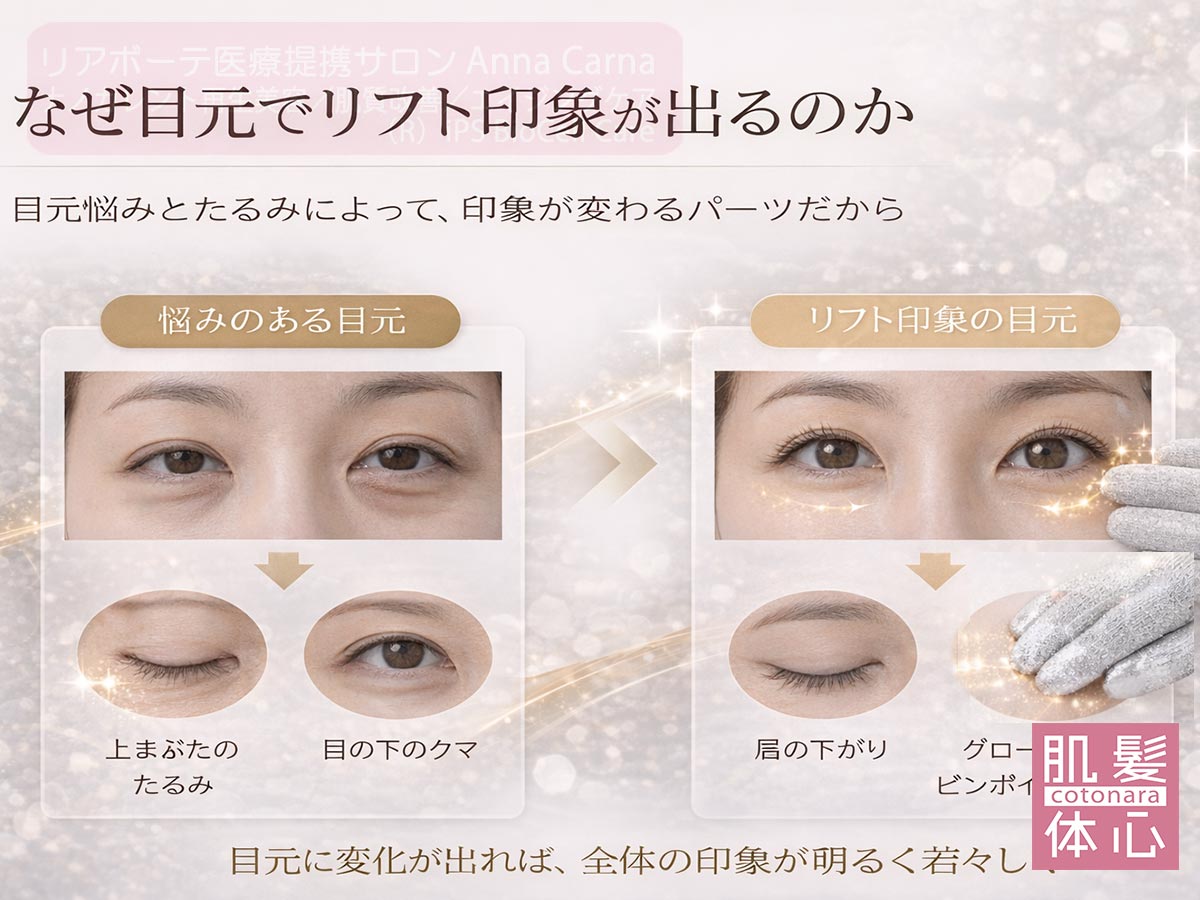 目元のたるみ・クマ印象を整えるナノカレント目元リフト|切らない・注射しない EYE RE:DESIGN 南青山 AnnaCarna