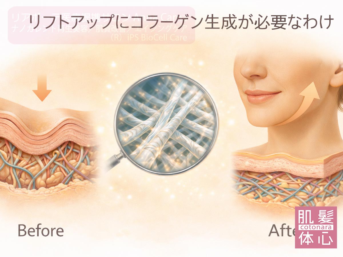 ナノカレント全顔リフトの鍵はコラーゲン生成｜たるみ・フェイスラインを整える FACE RE:DESIGN 南青山AnnaCarna