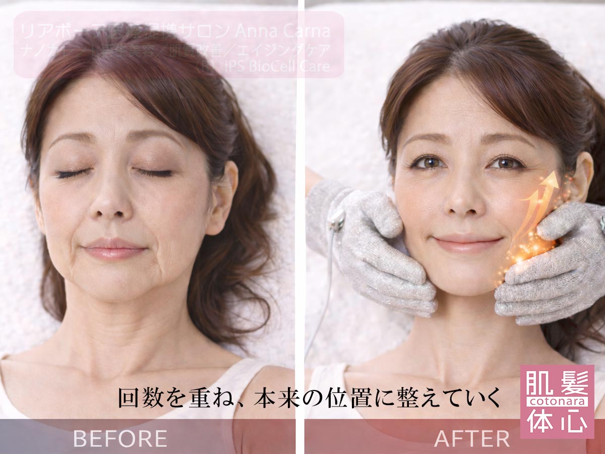 痛みが少ないナノカレント全顔施術の流れ｜切らない・注射しない・ダウンタイムなし