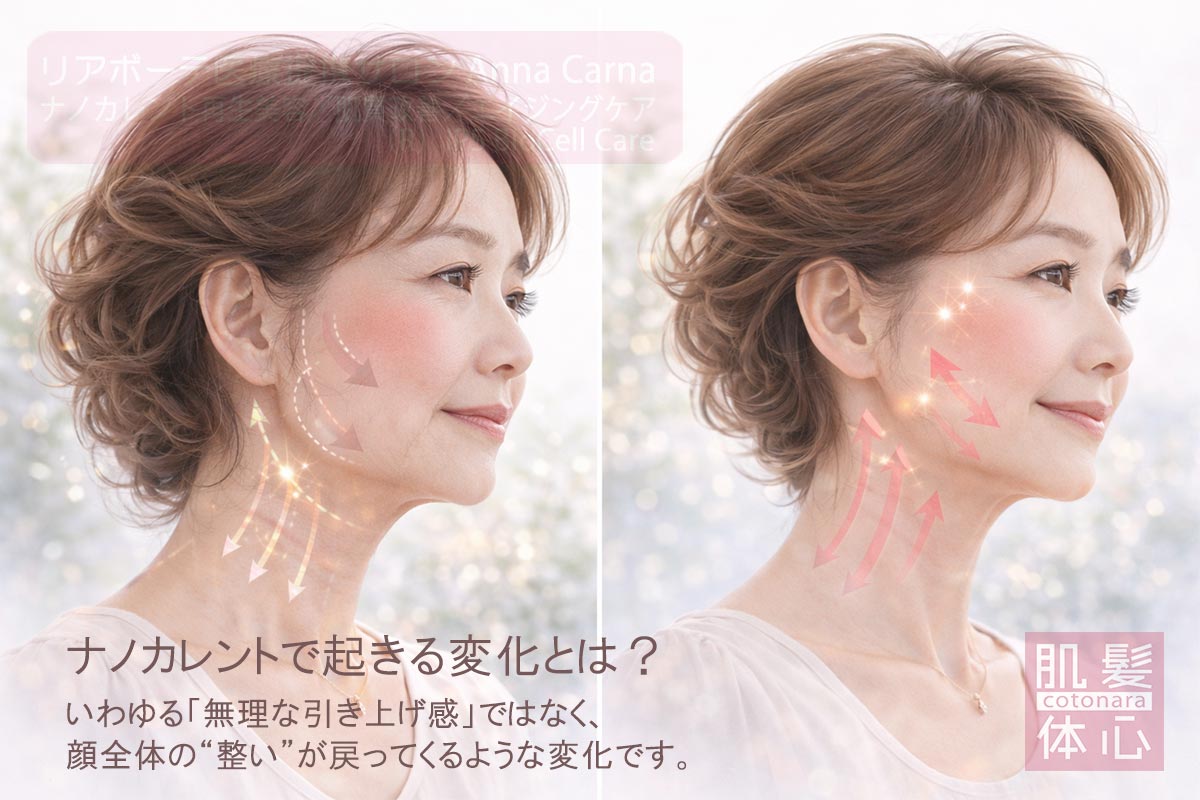 リアボーテ医療提携サロン AnnaCarna（アンナカルナ）のナノカレント全顔リフトによるフェイスライン改善イメージ