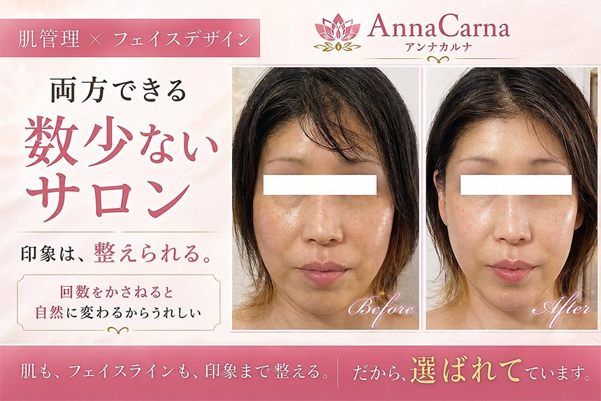 ナノカレントビフォーアフター写真｜芸能人ご用達・幹細胞コスメブランド・リアボーテ専門エステ・リアボーテ医療提携サロン AnnaCarna・リアボーテクレアスキン化粧品・リアボーテグランスキン化粧品・リアボーテシェリースキン化粧品・エキスパートローション・リアムール化粧品・エクラボーテ美顔器・正規取扱店・高濃度ヒト幹細胞培養液・ヒト幹細胞培養液・フェイシャル・ips細胞・ナノカレント・微弱電流・コラーゲン生成・筋膜・血流改善・リンパ・自律神経・再生美容・フェイスデザイン・リフトアップ・小顔・たるみケア・ほうれい線・マリオネットライン・フェイスラインもたつき・二重あご・目の下たるみ・クマ・青クマ・茶クマ・黒クマ・シミ・シミ取り・肝斑・色素沈着・ニキビ・ニキビ跡・毛穴・開き毛穴・たるみ毛穴・赤み・くすみ・乾燥・敏感肌・乾燥小じわ・ハリ・ツヤ・肌質改善・エイジングケア・年齢肌・頭活・頭皮ケア・育毛ケア・口コミ・評判・効果・使い方・ビフォーアフター・症例・動画・写真・施術方法・スキンケア方法・予約・当日予約・空き状況・料金・価格・体験・初回・再来・コース・メニュー・比較・おすすめ・人気・購入方法・販売店・正規販売・オンラインカウンセリング・発送対応・通販・ネット販売・禁止・対象外商品・カウンセリング必須・医療提携・専門サロン・完全個室・都度払い・勧誘なし・症例多数・実績・紹介・青山・港区・外苑前・東京・大阪・阿倍野区