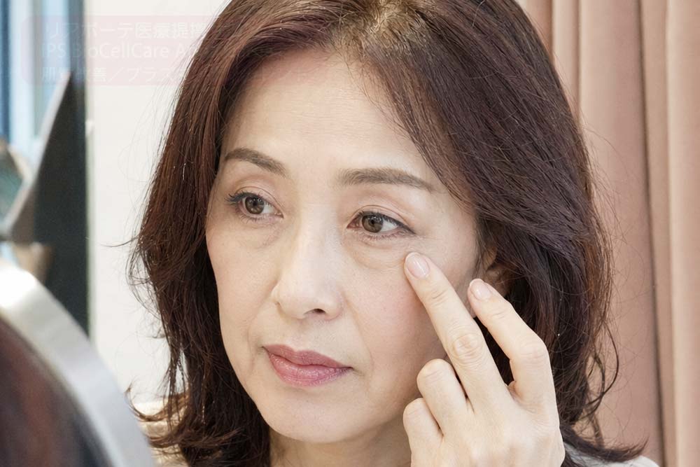 切らない・注射しない目元リフト（エステ）｜ナノカレント施術写真｜リアボーテ専門サロンAnnaCarna 南青山