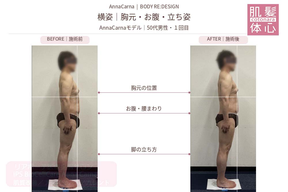 AnnaCarnaモデル・50代男性１回目の施術前後比較／反対側の横姿：胸元・お腹・立ち姿｜美容家や芸能人ご用達・幹細胞コスメブランド・リアボーテ専門エステ・リアボーテ医療提携サロン AnnaCarna・リアボーテクレアスキン化粧品・リアボーテグランスキン化粧品・リアボーテシェリースキン化粧品・エキスパートローション・リアムール化粧品・エクラボーテ美顔器・正規取扱店・高濃度ヒト幹細胞培養液・ヒト幹細胞培養液・フェイシャル・ips細胞・ナノカレント・微弱電流・コラーゲン生成・筋膜・血流改善・リンパ・自律神経・再生美容・フェイスデザイン・リフトアップ・小顔・たるみケア・ほうれい線・マリオネットライン・フェイスラインもたつき・二重あご・目の下たるみ・クマ・青クマ・茶クマ・黒クマ・シミ・シミ取り・肝斑・色素沈着・ニキビ・ニキビ跡・毛穴・開き毛穴・たるみ毛穴・赤み・くすみ・乾燥・敏感肌・乾燥小じわ・ハリ・ツヤ・肌質改善・エイジングケア・年齢肌・頭活・頭皮ケア・育毛ケア・口コミ・評判・効果・使い方・ビフォーアフター・症例・動画・写真・施術方法・スキンケア方法・予約・当日予約・空き状況・料金・価格・体験・初回・再来・コース・メニュー・比較・おすすめ・人気・購入方法・販売店・正規販売・オンラインカウンセリング・発送対応・通販・ネット販売・禁止・対象外商品・カウンセリング必須・医療提携・専門サロン・完全個室・都度払い・勧誘なし・症例多数・実績・紹介・青山・港区・外苑前・東京・大阪・阿倍野区