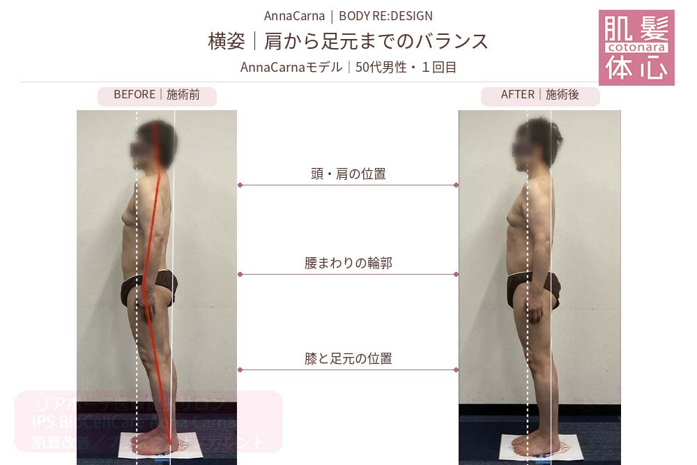 AnnaCarnaモデル・50代男性１回目の施術前後比較／横姿：肩から足元まで｜美容家や芸能人ご用達・幹細胞コスメブランド・リアボーテ専門エステ・リアボーテ医療提携サロン AnnaCarna・リアボーテクレアスキン化粧品・リアボーテグランスキン化粧品・リアボーテシェリースキン化粧品・エキスパートローション・リアムール化粧品・エクラボーテ美顔器・正規取扱店・高濃度ヒト幹細胞培養液・ヒト幹細胞培養液・フェイシャル・ips細胞・ナノカレント・微弱電流・コラーゲン生成・筋膜・血流改善・リンパ・自律神経・再生美容・フェイスデザイン・リフトアップ・小顔・たるみケア・ほうれい線・マリオネットライン・フェイスラインもたつき・二重あご・目の下たるみ・クマ・青クマ・茶クマ・黒クマ・シミ・シミ取り・肝斑・色素沈着・ニキビ・ニキビ跡・毛穴・開き毛穴・たるみ毛穴・赤み・くすみ・乾燥・敏感肌・乾燥小じわ・ハリ・ツヤ・肌質改善・エイジングケア・年齢肌・頭活・頭皮ケア・育毛ケア・口コミ・評判・効果・使い方・ビフォーアフター・症例・動画・写真・施術方法・スキンケア方法・予約・当日予約・空き状況・料金・価格・体験・初回・再来・コース・メニュー・比較・おすすめ・人気・購入方法・販売店・正規販売・オンラインカウンセリング・発送対応・通販・ネット販売・禁止・対象外商品・カウンセリング必須・医療提携・専門サロン・完全個室・都度払い・勧誘なし・症例多数・実績・紹介・青山・港区・外苑前・東京・大阪・阿倍野区