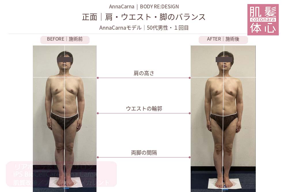 AnnaCarnaモデル・50代男性１回目の施術前後比較／正面：肩・ウエスト・脚｜美容家や芸能人ご用達・幹細胞コスメブランド・リアボーテ専門エステ・リアボーテ医療提携サロン AnnaCarna・リアボーテクレアスキン化粧品・リアボーテグランスキン化粧品・リアボーテシェリースキン化粧品・エキスパートローション・リアムール化粧品・エクラボーテ美顔器・正規取扱店・高濃度ヒト幹細胞培養液・ヒト幹細胞培養液・フェイシャル・ips細胞・ナノカレント・微弱電流・コラーゲン生成・筋膜・血流改善・リンパ・自律神経・再生美容・フェイスデザイン・リフトアップ・小顔・たるみケア・ほうれい線・マリオネットライン・フェイスラインもたつき・二重あご・目の下たるみ・クマ・青クマ・茶クマ・黒クマ・シミ・シミ取り・肝斑・色素沈着・ニキビ・ニキビ跡・毛穴・開き毛穴・たるみ毛穴・赤み・くすみ・乾燥・敏感肌・乾燥小じわ・ハリ・ツヤ・肌質改善・エイジングケア・年齢肌・頭活・頭皮ケア・育毛ケア・口コミ・評判・効果・使い方・ビフォーアフター・症例・動画・写真・施術方法・スキンケア方法・予約・当日予約・空き状況・料金・価格・体験・初回・再来・コース・メニュー・比較・おすすめ・人気・購入方法・販売店・正規販売・オンラインカウンセリング・発送対応・通販・ネット販売・禁止・対象外商品・カウンセリング必須・医療提携・専門サロン・完全個室・都度払い・勧誘なし・症例多数・実績・紹介・青山・港区・外苑前・東京・大阪・阿倍野区