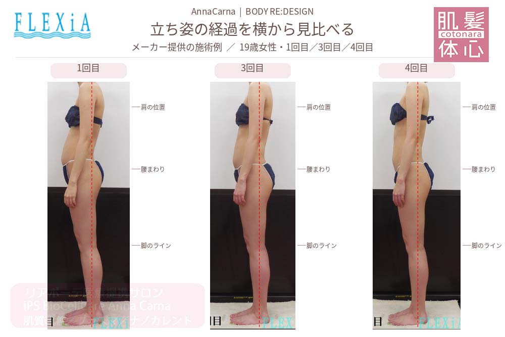 FTIナノカレントビフォーアフター写真｜美容家や芸能人ご用達・幹細胞コスメブランド・リアボーテ専門エステ・リアボーテ医療提携サロン AnnaCarna・リアボーテクレアスキン化粧品・リアボーテグランスキン化粧品・リアボーテシェリースキン化粧品・エキスパートローション・リアムール化粧品・エクラボーテ美顔器・正規取扱店・高濃度ヒト幹細胞培養液・ヒト幹細胞培養液・フェイシャル・ips細胞・ナノカレント・微弱電流・コラーゲン生成・筋膜・血流改善・リンパ・自律神経・再生美容・フェイスデザイン・リフトアップ・小顔・たるみケア・ほうれい線・マリオネットライン・フェイスラインもたつき・二重あご・目の下たるみ・クマ・青クマ・茶クマ・黒クマ・シミ・シミ取り・肝斑・色素沈着・ニキビ・ニキビ跡・毛穴・開き毛穴・たるみ毛穴・赤み・くすみ・乾燥・敏感肌・乾燥小じわ・ハリ・ツヤ・肌質改善・エイジングケア・年齢肌・頭活・頭皮ケア・育毛ケア・口コミ・評判・効果・使い方・ビフォーアフター・症例・動画・写真・施術方法・スキンケア方法・予約・当日予約・空き状況・料金・価格・体験・初回・再来・コース・メニュー・比較・おすすめ・人気・購入方法・販売店・正規販売・オンラインカウンセリング・発送対応・通販・ネット販売・禁止・対象外商品・カウンセリング必須・医療提携・専門サロン・完全個室・都度払い・勧誘なし・症例多数・実績・紹介・青山・港区・外苑前・東京・大阪・阿倍野区